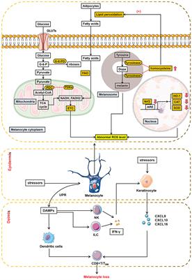 Frontiers | Immunometabolism In The Pathogenesis Of Vitiligo